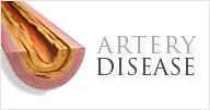 Artery - Vanda Rossen