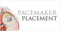 pacemaker - Vanda Rossen